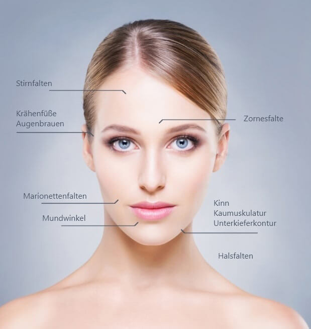 Welche Bereiche lassen sich mit Botox® gut behandeln?