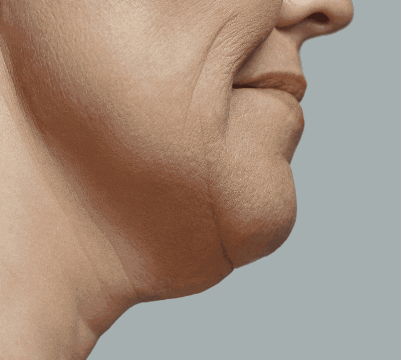 Gesichtsmodellierung Berlin