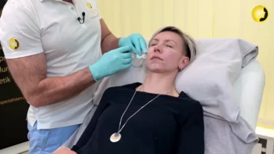 Dr. med. Karsten Lange bei der Faltenbehandlung mit Hyaluron in der Ästhetikwelt Berlin